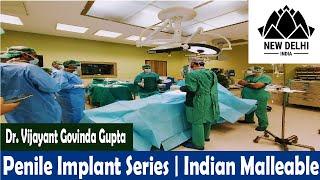 Indian Malleable Penile Implant | Penile Prosthesis Surgery Video