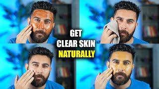 GET CLEAR SKIN NATURALLY AT HOME | Remove Acne, Dark Spots & Pigmentation | SKIN GLOW IN 5 MINS