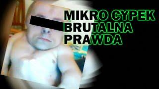 Czarek Official (Mikro Cypek) - Brutalna przeszłość niepełnosprawnego Youtubera