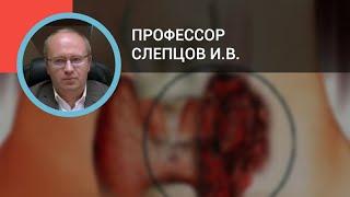 Профессор Слепцов И.В.: Рак щитовидной железы: диагностика и лечение