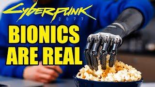 Real bionic tech is making 2024 look like Cyberpunk 2077