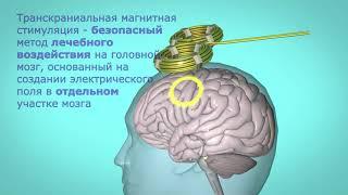 Транскраниальная магнитная стимуляция (ТМС) в клинике Neurolab