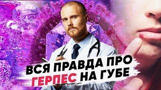 Опасен ли вирус герпеса? Герпес на губах лечение. Можно ли избавиться от вируса герпеса навсегда.