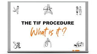 The TIF Procedure: What is it?