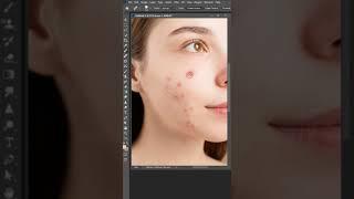 Power of Healing Brush Tool Photoshop#shorts #illustrator