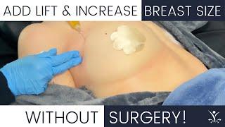 PRP Breast Injections for a Non-Surgical Breast Lift!