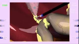 SinaSim Laparoscopic Cholecystectomy Simulation - Dissection