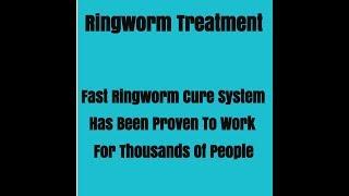 Ehowhealth  - How to Kill Ringworm - Ehowhealth