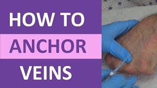 How to Anchor Veins | Venipuncture, IV Therapy, Blood Draw, Phlebotomy Rolling Veins