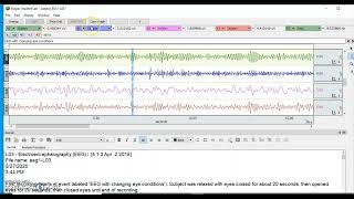 How to Use BIOPAC