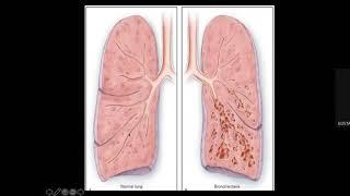 Semiologia del sistema respiratorio en pediatría