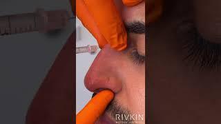 5 Minute Nose job By Dr. Rivkin!