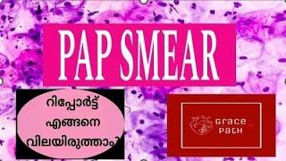 PAP Smear / Cervical Smear (Malayalam)