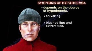 Hypothermia , UPDATE - Everything You Need To Know - Dr. Nabil Ebraheim