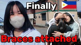 Teeth Braces in Japan | Filipino Single Father in Japan