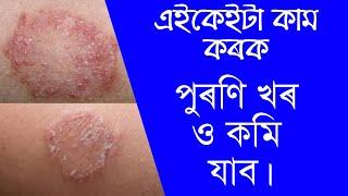 এইকেইটা কাম কৰিলে খৰ কমিব||Daily Assamese tips||Daily tips of healthcare||Assamese health tips