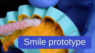 Mock-up: tips and tricks for a successful smile prototype