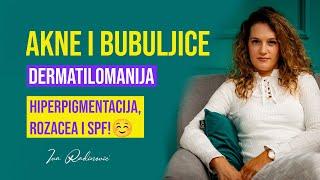 PRE SVEGA... Dermatilomanija, Akne kod Mladih, Adult Acne i Hiperpigmentacija | Iva Radinović #024