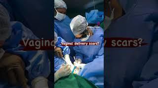 Vaginal delivery scar removal / Dr. Deepa Ganesh / Cosmetic Gynecologist