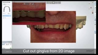 3Shape Dental System 2D Realview