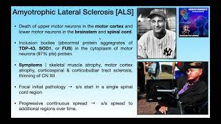 Amyotrophic Lateral Sclerosis [ALS] | Basics & Clinical Presentation