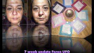 FOREO UFO device - nearly 7 weeks on. Was it worth it?