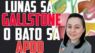 Lunas sa Gallstone o Bato sa Apdo - by Doc Liza Ramoso-Ong #356