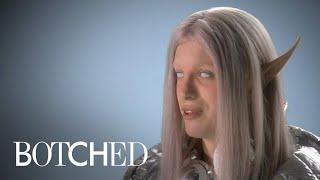 "Botched" Patient Wants to Be the Perfect Space Elf | E!