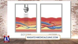 No surgery, injections or even pills.  Acoustic Wave Therapy could be the end to E.D.