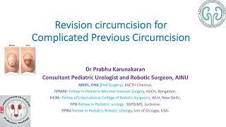 Dr Prabhu's Pediatric Urology- When circumcision gets complicated, needs expert hands to correct it