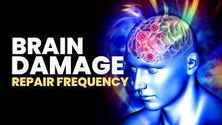 Brain Damage Repair Frequency | Brain Cell Regeneration and Healing | Theta Binaural Beats | 432Hz