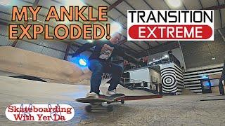 My Ankle EXPLODED at Transition Extreme Skatepark in Aberdeen