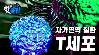 자가면역 질환의 원인은 T세포? [핫클립] / YTN 사이언스