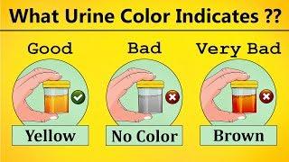 What The Urine Color States About Your Health ?  | Urine Infection, Urine Diseases, Urine Problem