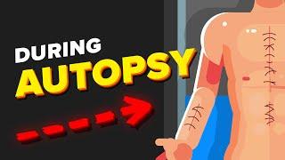 What Actually Happens During an Autopsy