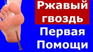 Что делать если наступил на ржавый гвоздь и нога опухла? | Я знаю