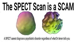 Amen Clinics SPECT Scan/scam - an Alternate Viewpoint