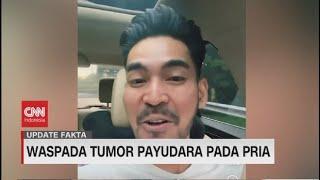 Waspada Tumor Payudara Pada Pria