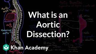What is an aortic dissection? | Circulatory System and Disease | NCLEX-RN | Khan Academy