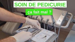 Qu'est ce qu'un soin de Pédicurie? (Pédicure-Podologue)