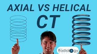 CT Scan Modes Compared (Axial vs Helical)