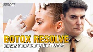 BOTOX resolve rugas profundas na testa? | Sua Dúvida Vira Vídeo #87