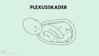 Hvorfor er armen min annerledes? Fødselsrelatert plexusskade