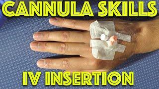 Cannula Insertion Technique Practice - IV Access - Clinical Skills - Dr. Gill