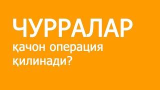 Чурралар қачон операция қилинади?