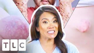 Every BEST Lump, Bump, Cyst, Pop & More Seen On Dr Pimple Popper!