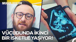 1 Bölüm 1 Vaka: Anne Karnında İkizini Yiyen Adam! - Mucize Doktor