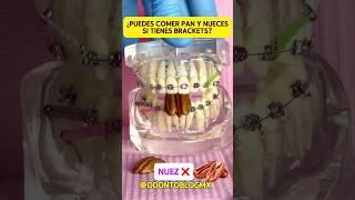 ¿Puedes comer pan y nueces si tienes brackets? #shorts #odontoblog #brackets #ortodoncia #odonto