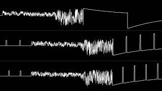 Chris Huelsbeck - "Starball (C64) - Title Theme" [Oscilloscope View]