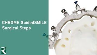 GuidedSMILE Surgical Steps Video